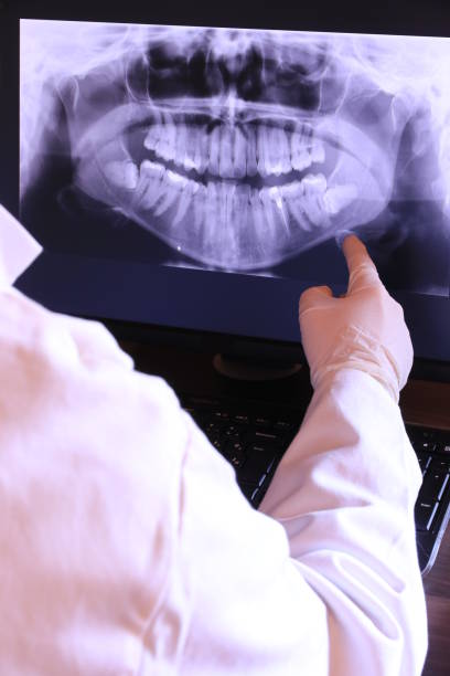 Best Emergency Dental Extractions in Trevose, PA